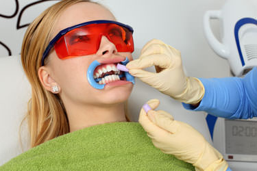 M L Crowe Ipswich Dentist Whitening Procedure